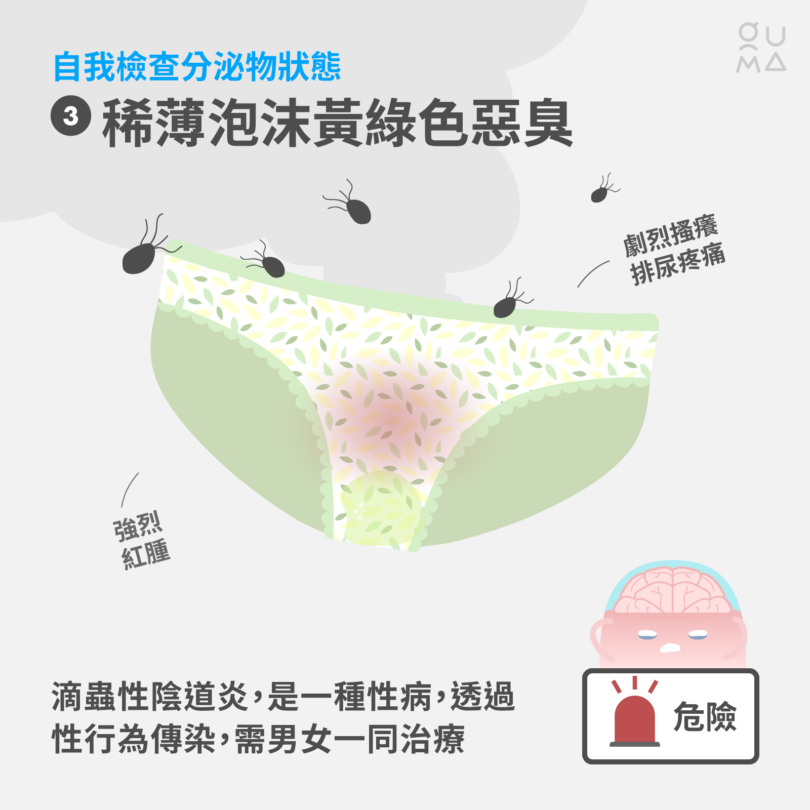 內褲總是濕濕的？女孩天天都會有的分泌物