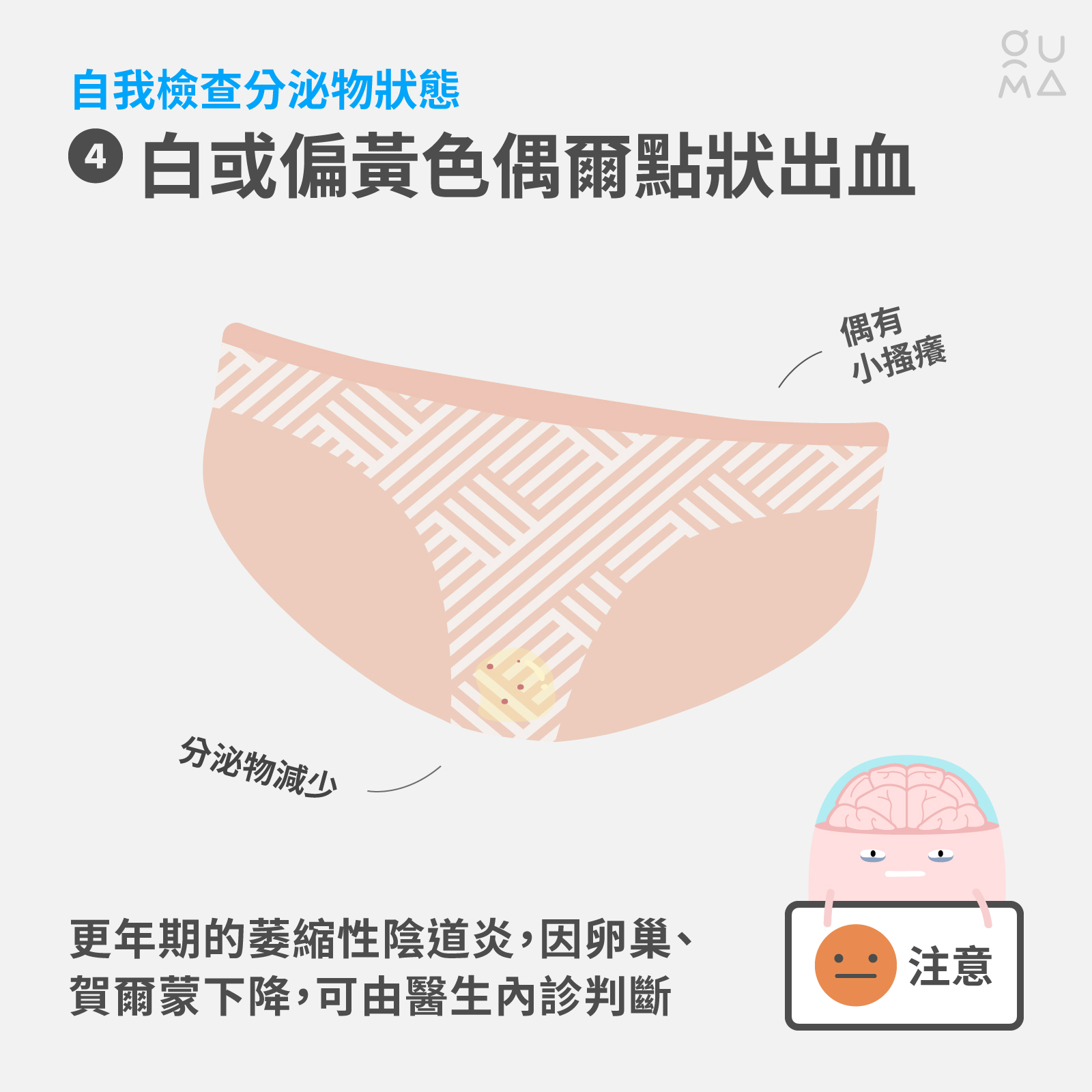 內褲總是濕濕的？女孩天天都會有的分泌物