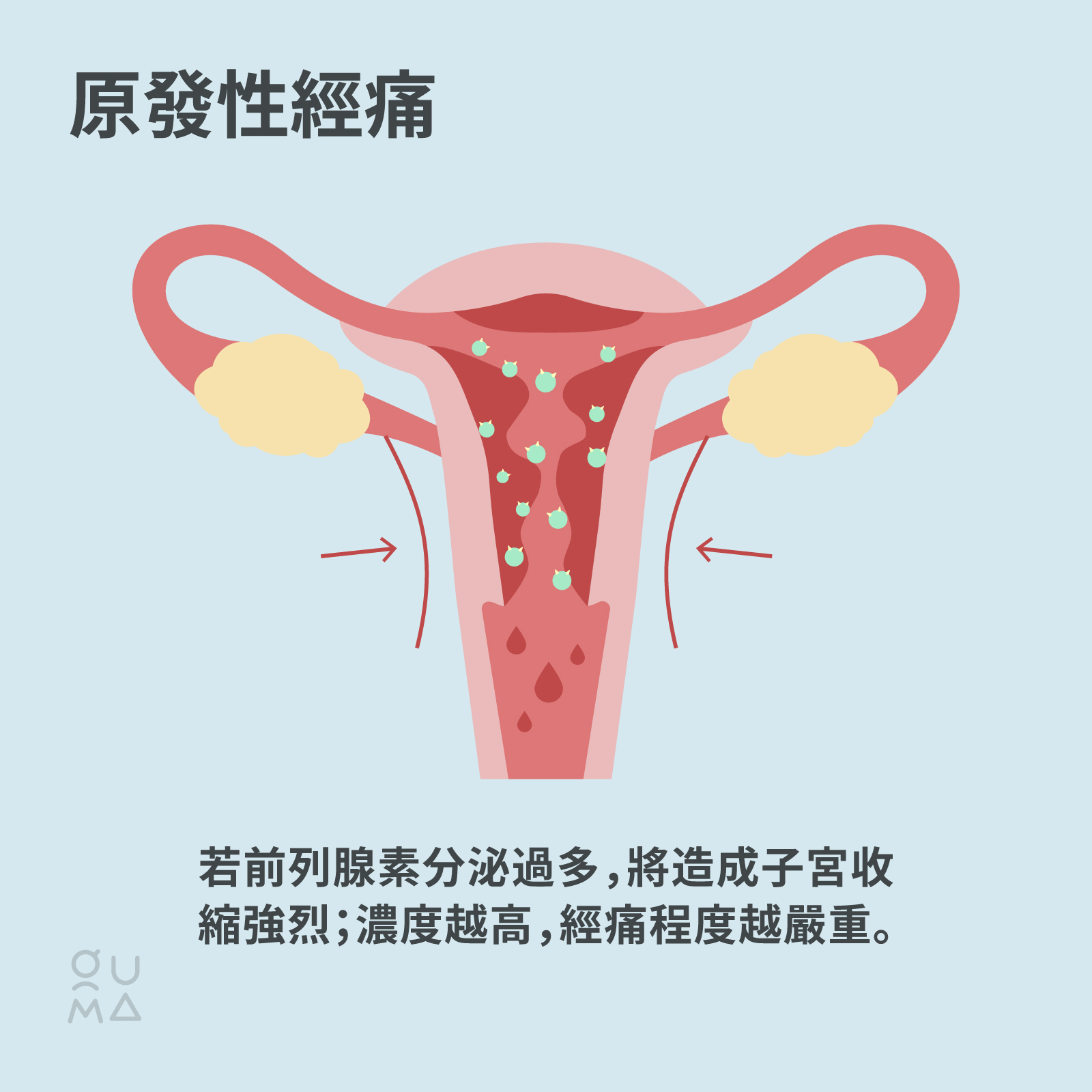 經痛止痛藥該怎麼選？